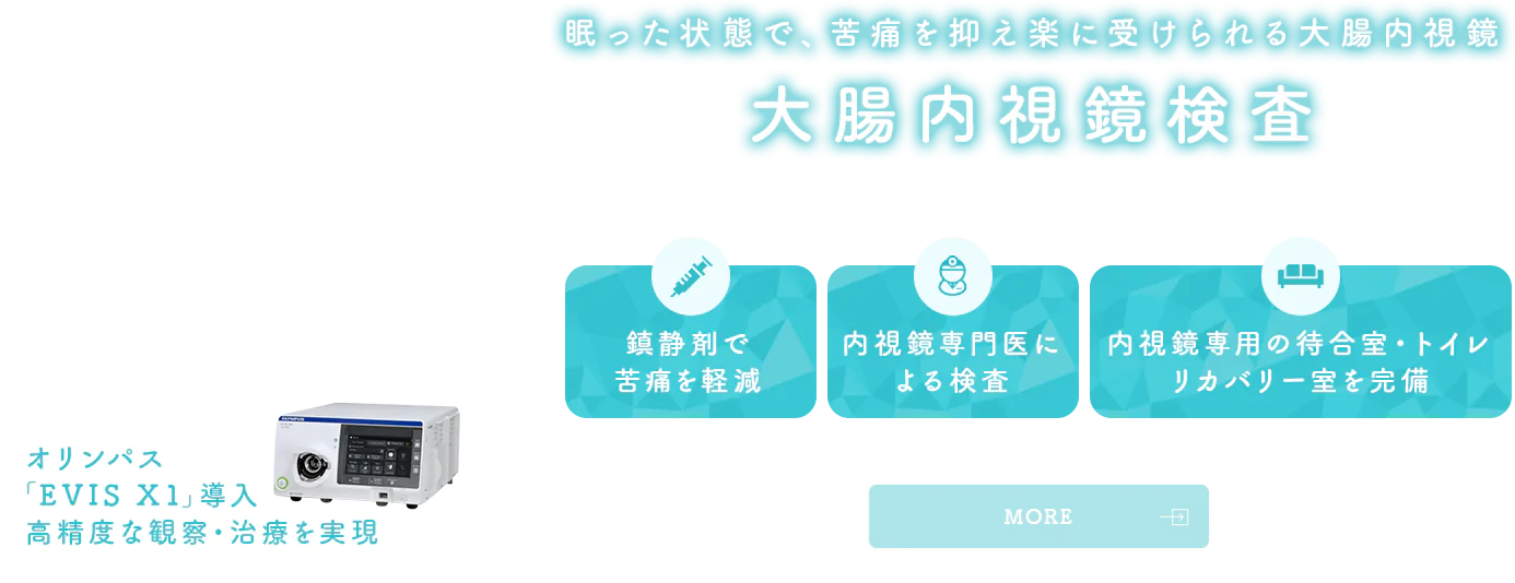 眠った状態で、苦痛を抑え楽に受けられる大腸内視鏡 大腸内視鏡